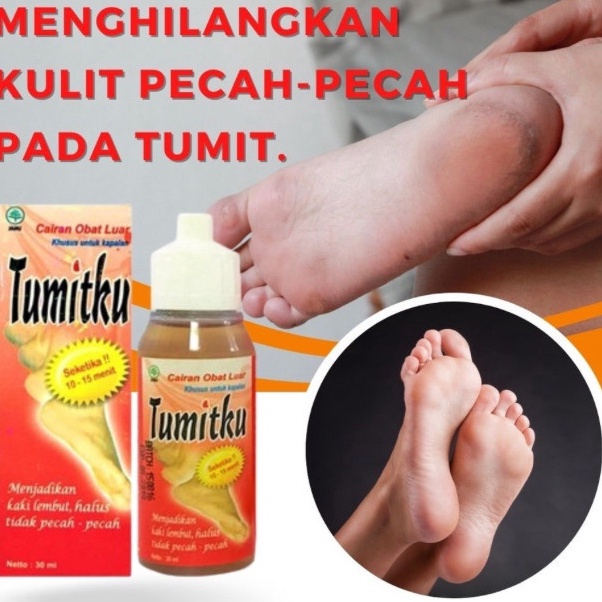 STOK SIAP COD Obat Kaki Pecah Dan Kering Penghalus Tumit Penghilang Kaki Kapalan Kering Kasar Pecah 