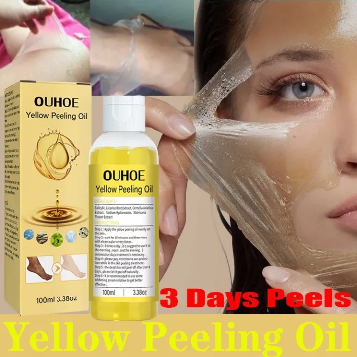 [AW]OUHOE Original Peeling Oil Body Peeling Skin Rejuvenation Essential Oil Whitening Skin 100ml-COD