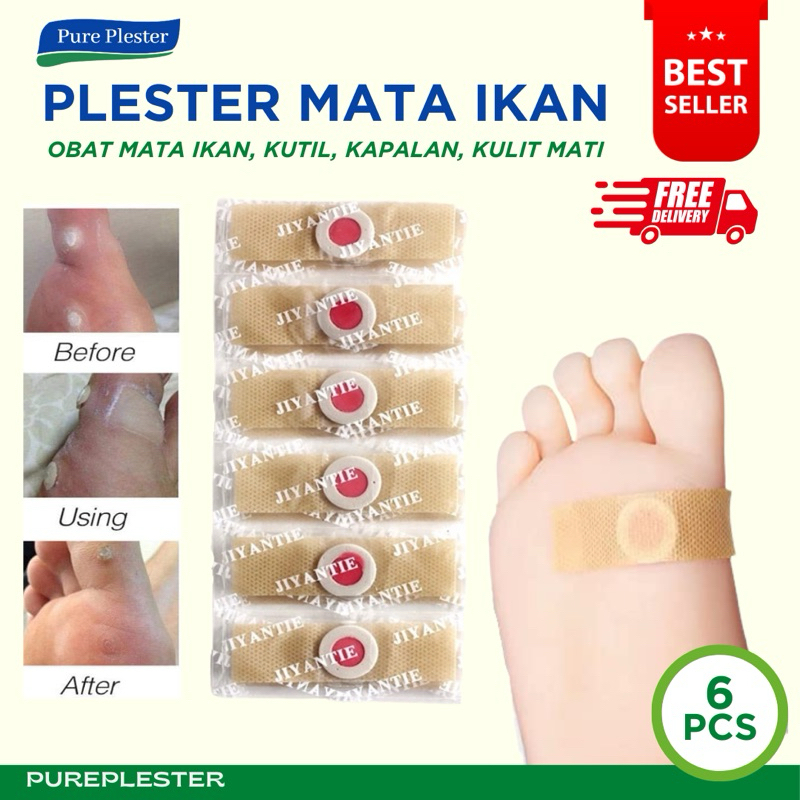 PLESTER OBAT MATA IKAN DAN KUTIL 1 STRIP 6 PLESTER CALLUSOL REMOVER / PLASTER KAPALAN LP