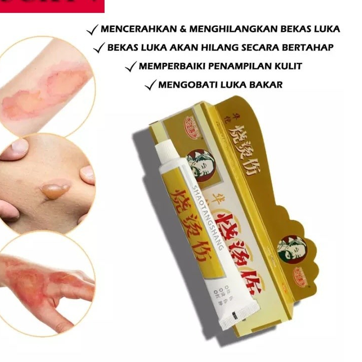 BISA COD  Hua tuo Salep Cina Luka Bakar Minyak Panas Knalpot Paling Ampuh
