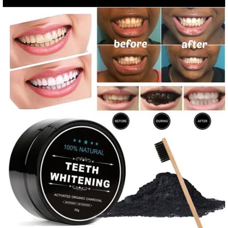 *ft** [[ TEETH WHITENING ]] pembersih / pemutih gigi teeth whitening