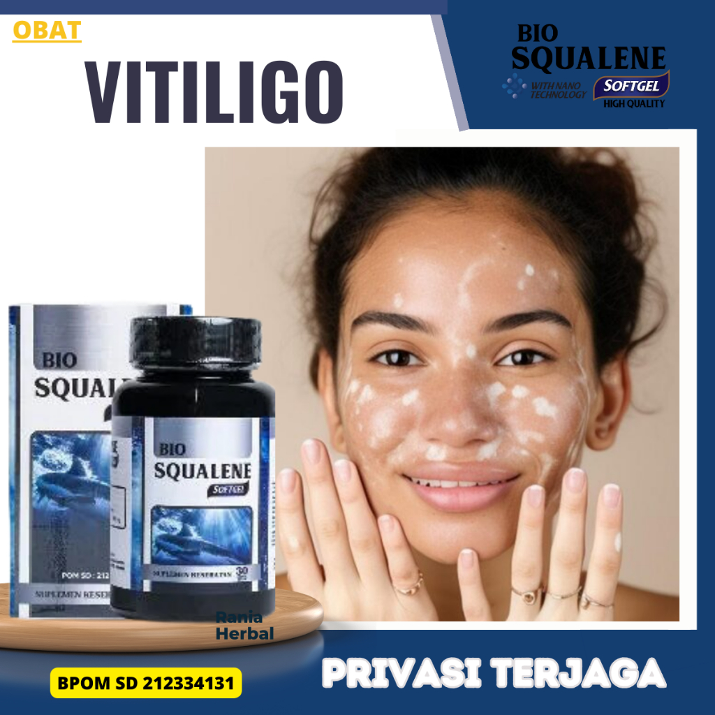 Obat Vitiligo Kulit Bercak Belang Putih, Obat Penghilang Bercak Putih, Obat Vitiligo di Wajah dan Le