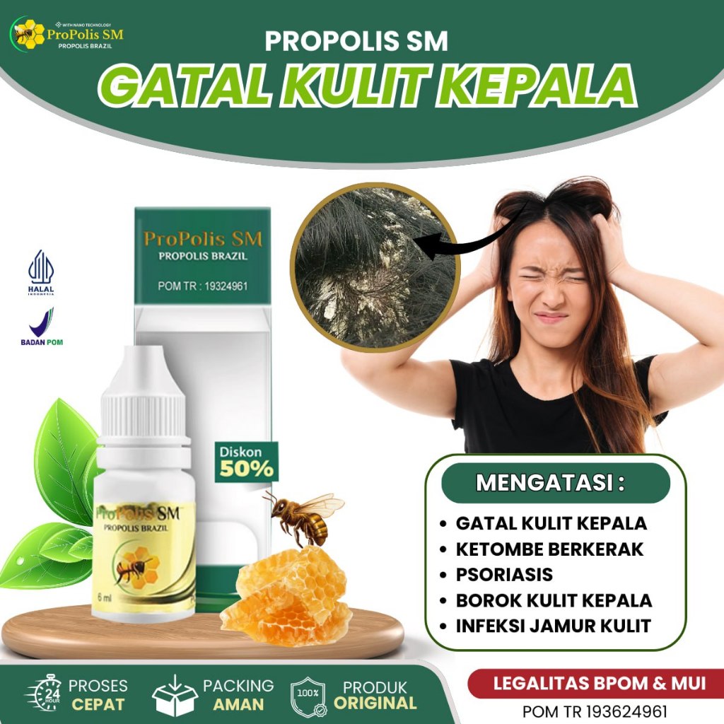 Obat Gatal Parah di Kulit Kepala, Obat Gatal Jamur Kulit Kepala, Obat Anti Ketombe Basah Kering Kera