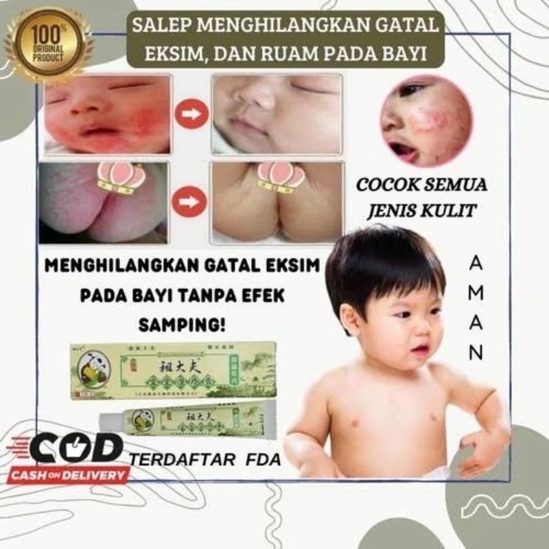 Salep Gatal Zudaifu untuk Bayi dan Anak