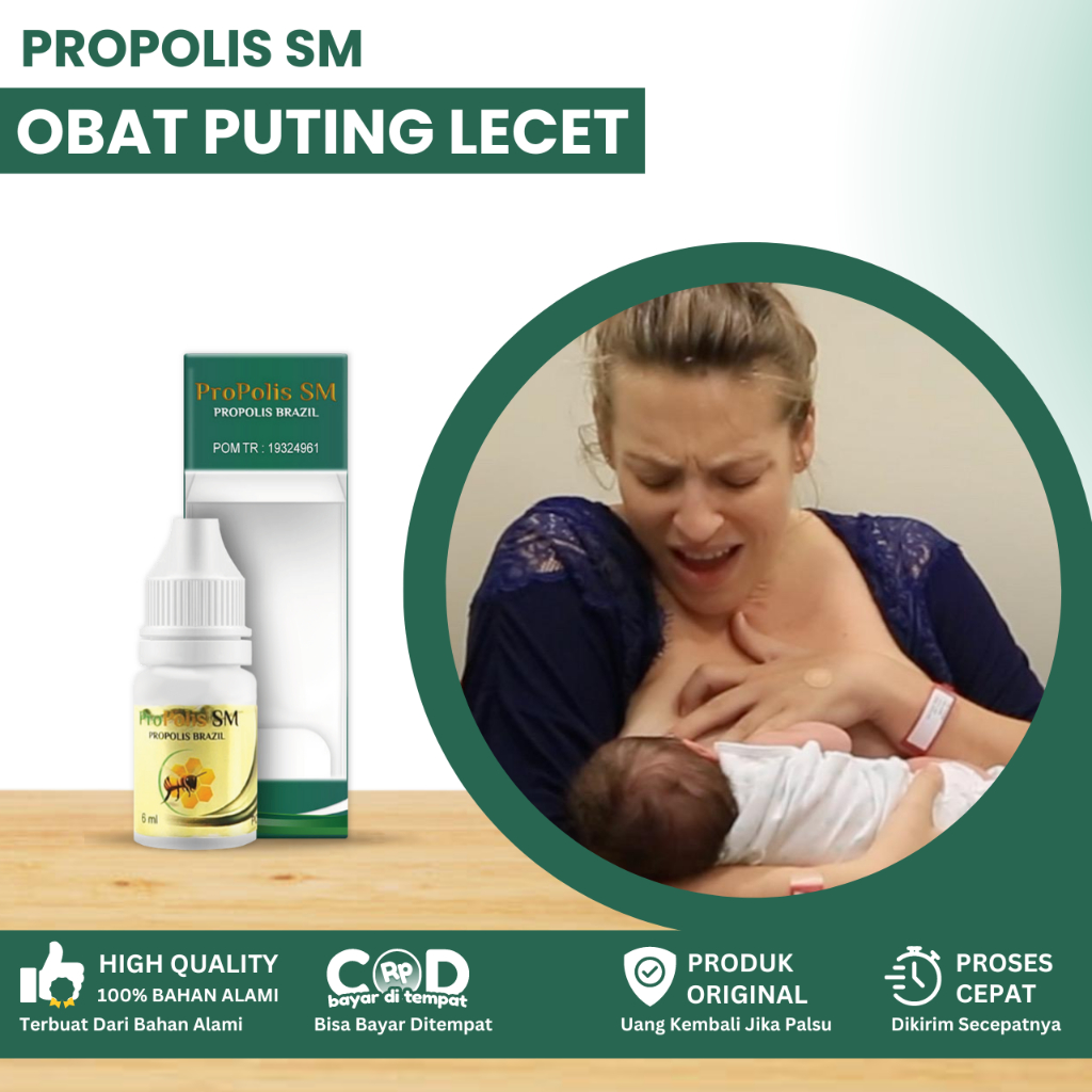 Obat Puting Lecet, Obat Puting Lecet Akibat Menyusui, Obat Puting Luka, Luka Karena Gigitan Bayi, Pa