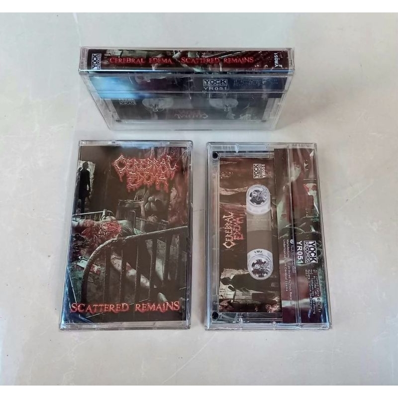 Kaset CEREBRAL EDEMA - Scattered Remains