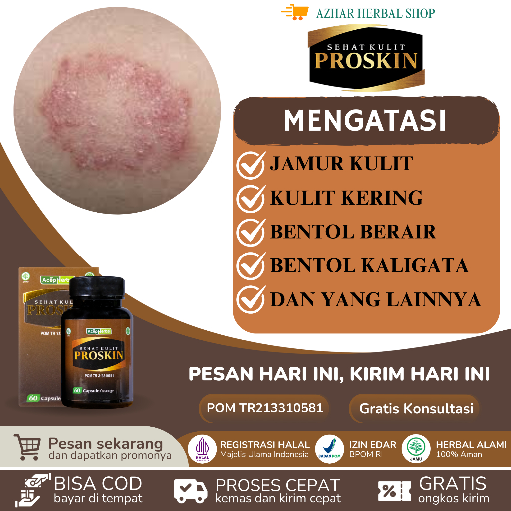 Proskin - Obat Jamur Kulit Gatal Obat Kulit Kering gatal Obat Kulit Berair Gatal Obat Kulit Bersisik