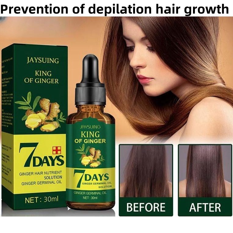 7 Days King Of Ginger Oil 30ml Serum Penumbuh Rambut Anti Rontok Botak Ginger Germinal Oil Obat Penu