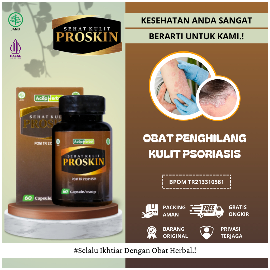 Obat Gatal Psoriasis, Obat Psoriasis Menahun, Obat Psoriasis Kulit Kering, Obat Psoriasis Kulit Kapa