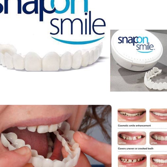 Diskon Snap On Smile 1 Original Gigi Palsu Atas Bawah Instan Gigi Palsu Silikon Alami Authentic Pemu