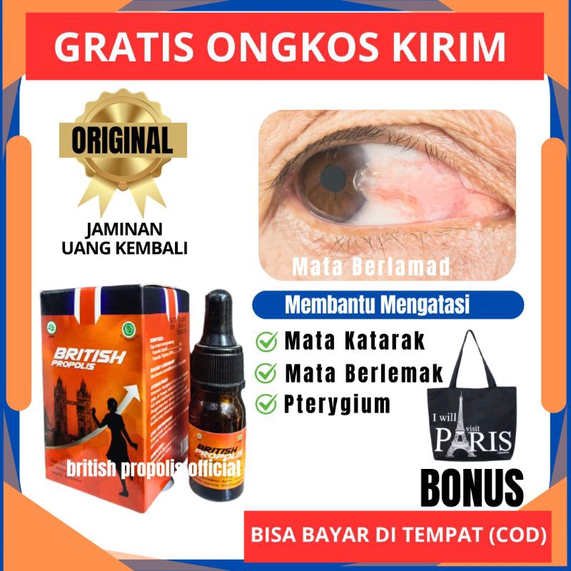 BRITISH PROPOLIS OBAT HERBAL KATARAK OBAT MATA BERLEMAK PEMBERSIH PTERYGIUM PENGHILANG LAMAD