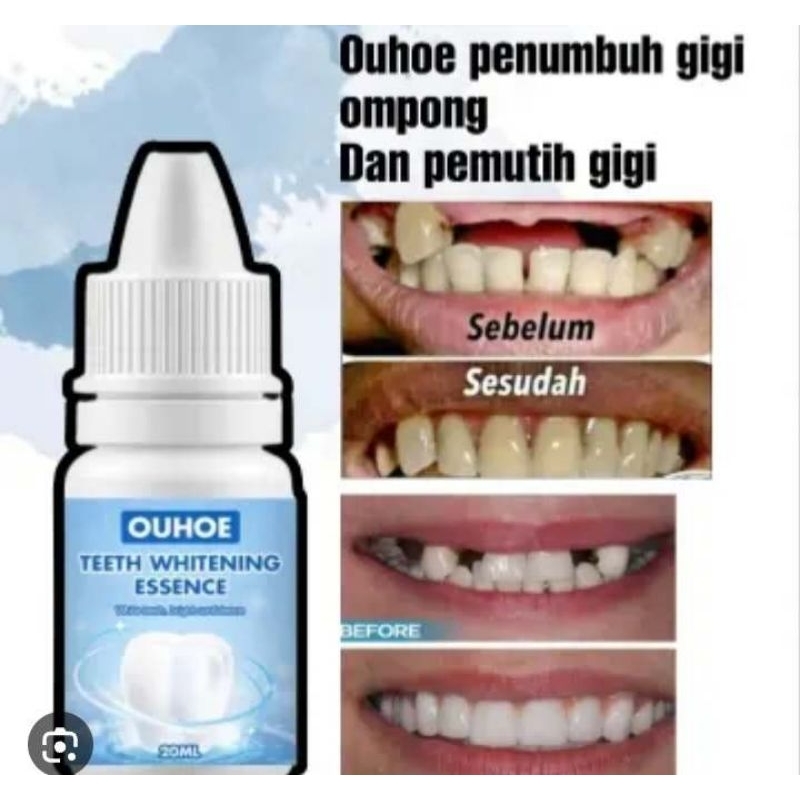 [ COD ] TOOTH DECAY | GROSIR | OBAT TETES PENUMBUH GIGI BOLONG/ BERLUBANG/ OBAT SAKIT GIGI BERLUBANG