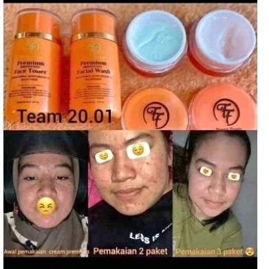 fenny frans cream ff premium cream ff miracle cream ff glow cream ff fass cream ff whitening cream f