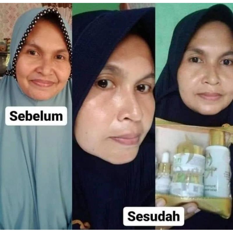 (PROMO) RATU GLOW BPOM SKINCARE FLEK PARAH DAN JERWAT