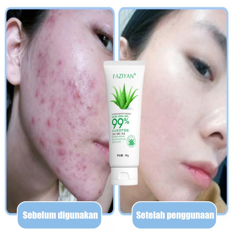 Aloe Vera Gel Pelembab gel lidah buaya Hydrating Moisturizing Aloe Vera Cream Repair Skin bekas jera