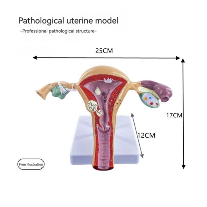 Manikin Uterus Ovary Anatomical Model Anatomy