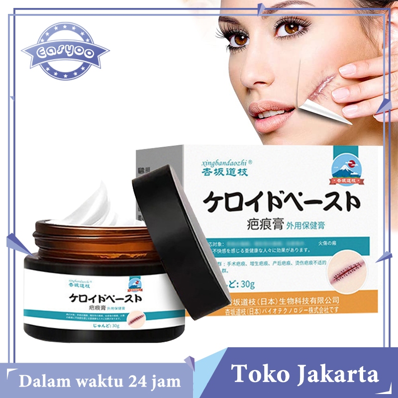 Salep Penghilang Bekas Luka Hitam Menghilangkan Bekas Luka Penghilang Luka Hitam Salap Penghilang Be