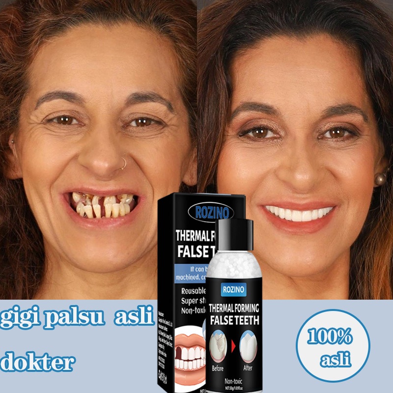 Penambal gigi Tambal gigi Gigi palsu Tambal gigi permanen Penambal gigi berlubang 30ml Penambal gigi