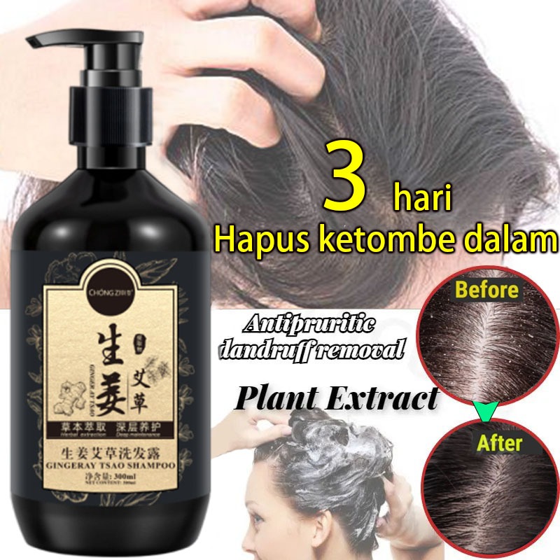 Sampo anti ketombe sampo kutu rambut obat kutu rambut 300ml Jahe dan Apsintus sampo anti ketombe Mer