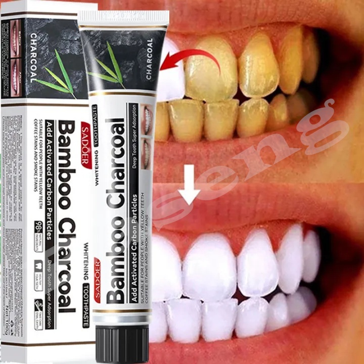 Alat pemutih gigi Whitening toothpaste alat pembersih karang gigi 100g pasta gigi pemutih gigi perma