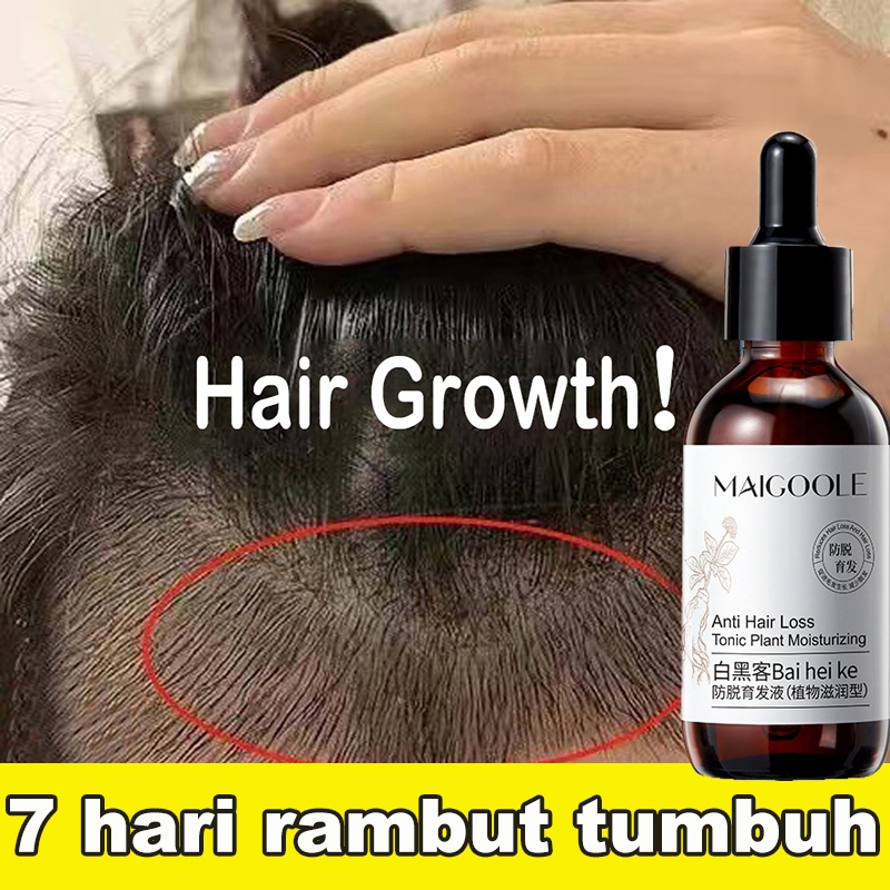 [100% Asli ] Penumbuh rambut Penumbuh rambut botak Hair serum rambut rontok60ml mencegah kerontokan 