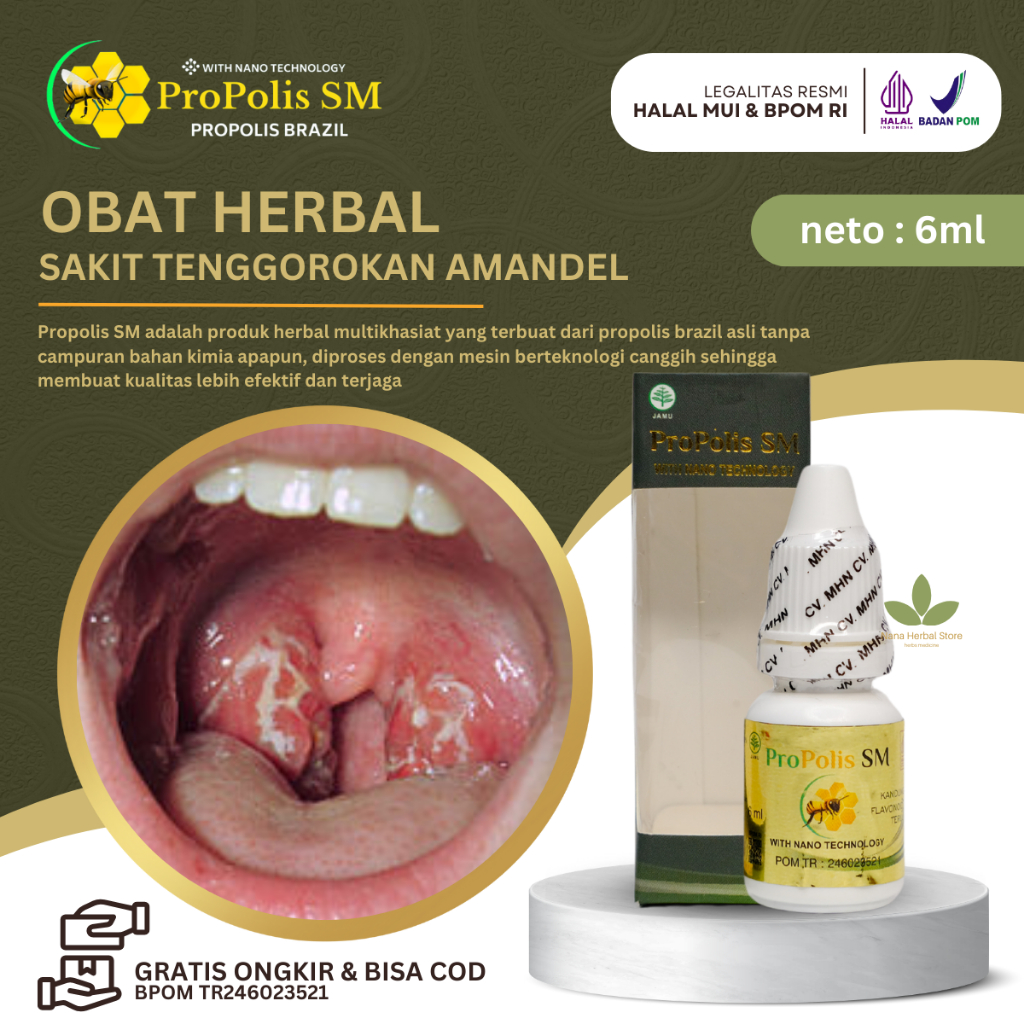 Obat Herbal Propolis SM Brazilian 6ml Obat Amandel Akut, Pengempes Amandel, Amandel Bengkak Sebelah