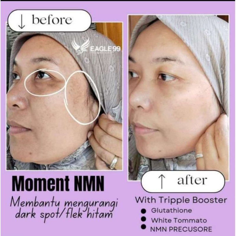 NMN MOMENT TRIPLE BOOSTER ANTI AGING ORIGINAL 100%
