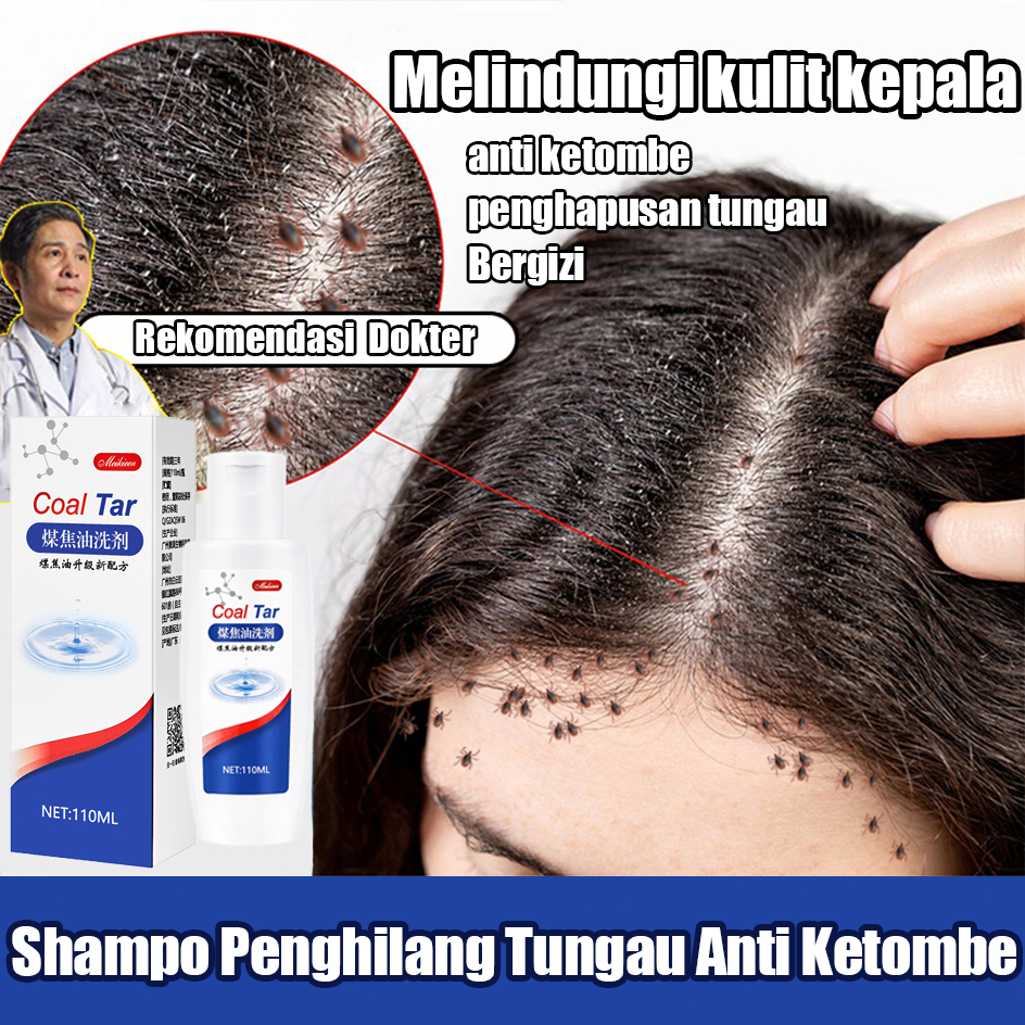 Shampoo Kutu Rambut Sampo Ketombe Shampo Kutu Rambut Anak Telur Kutu Rambut Shampo Anti Ketombe Dan 