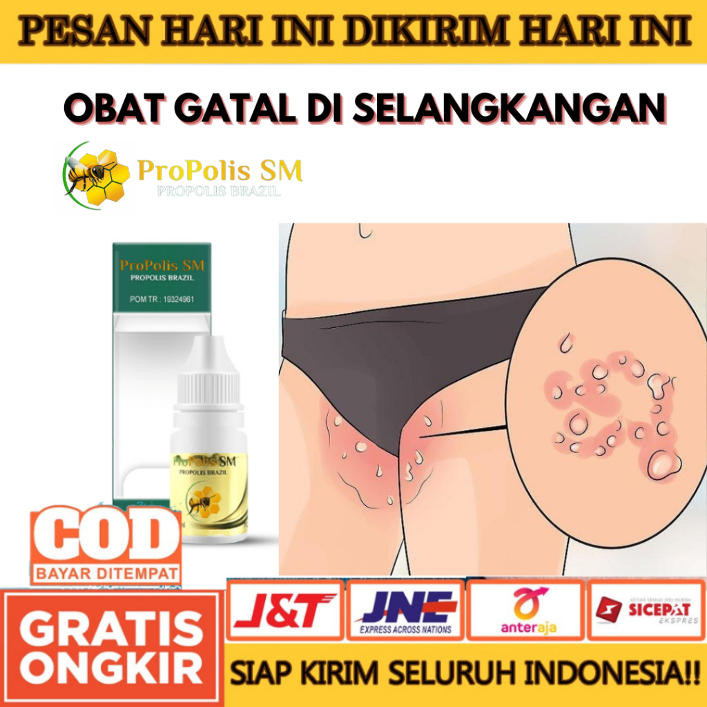 obat gatal di selangkangan,obat gatal selangkangan,selangkangan gatal gatal dengan propolis sm medan