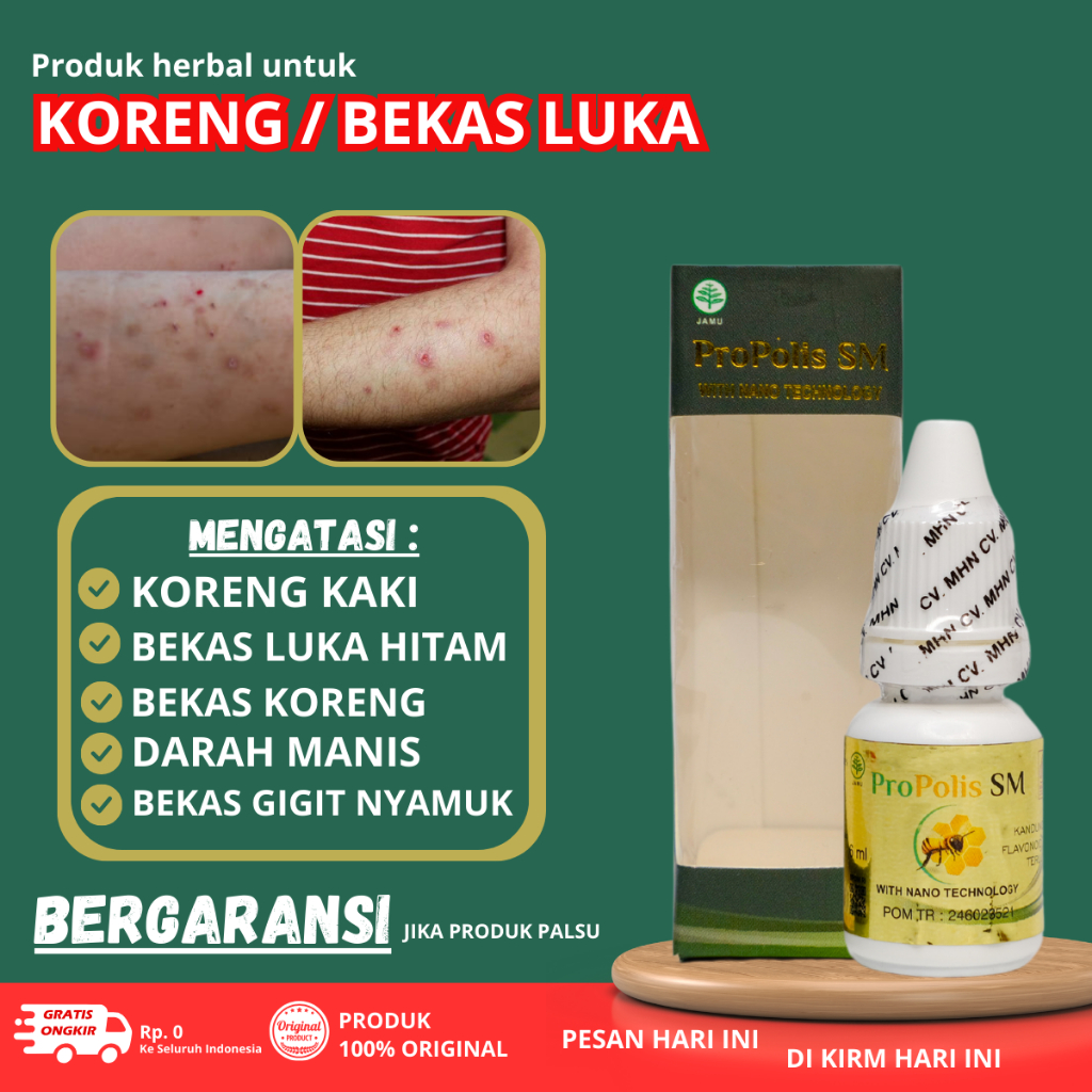Obat bekas luka koreng, Penghilang bekas koreng, Penghilang bekas luka di kaki, Obat penghilang kore