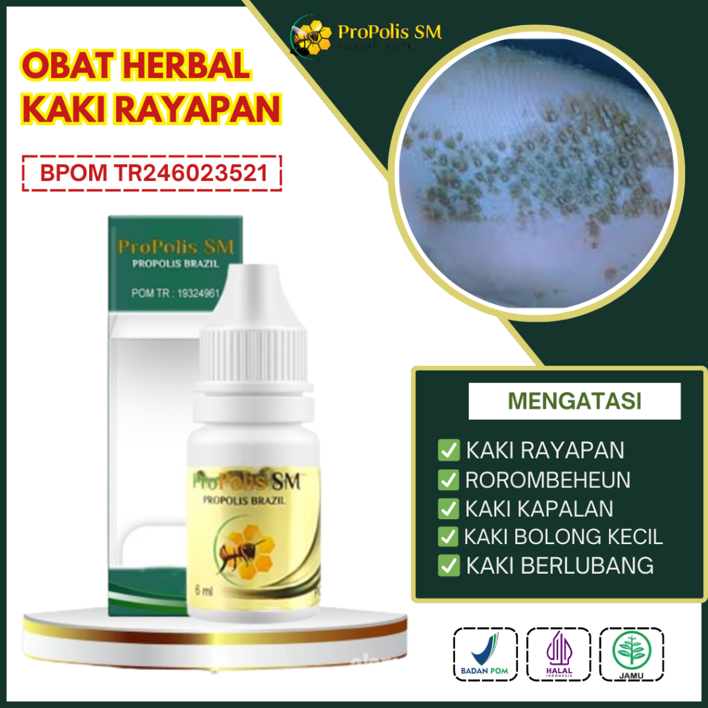 Obat Kaki Rayapan, Obat Telapak Kaki Bolong Bolong, Obat Kaki Rorombeheun, Obat Telapak Kaki Pecah P