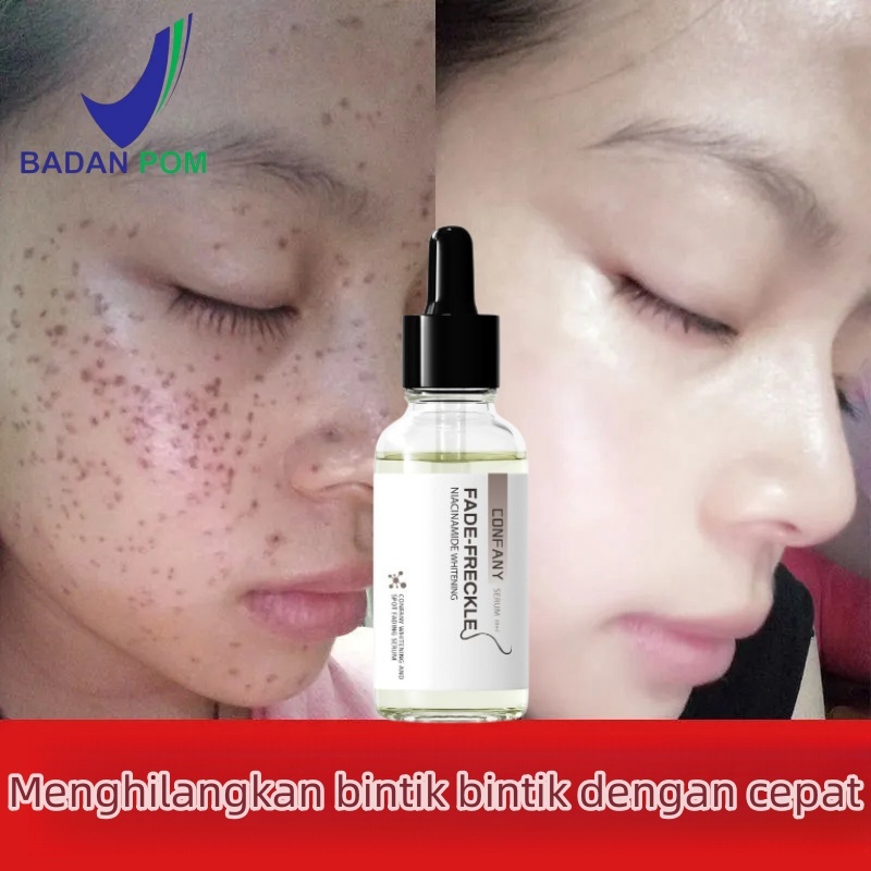 BPOM Penghilang flek hitam di wajah Serum penghilang flek hitam flek hitam di wajah membandel untuk