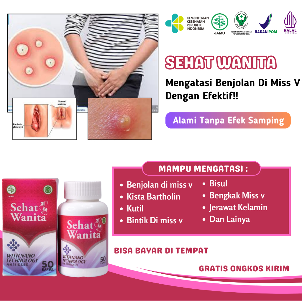 Obat Benjolan di miss v Bisul Infeksi Jamur - Sehat Wanita Original Asli