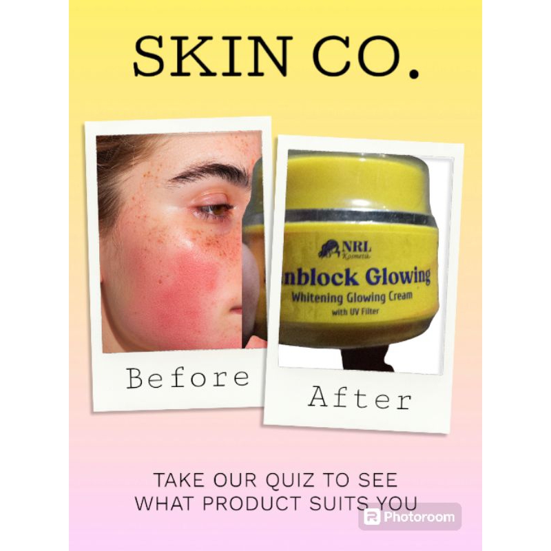 sunblock NRL