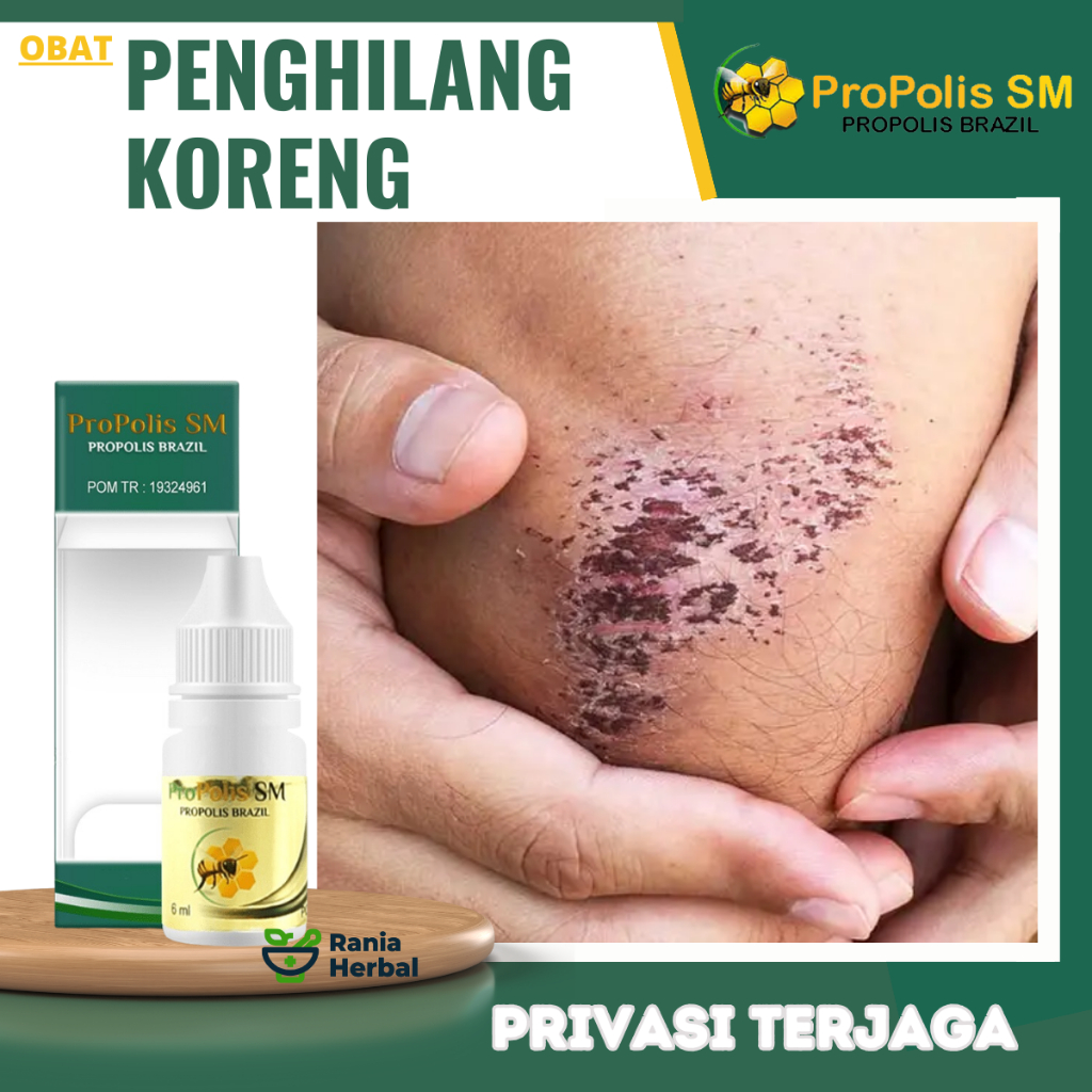 Obat Penghilang Koreng, Obat Koreng Di Kaki, Obat Penghilang Bekas Koreng, Obat Penghilang Bekas Luk