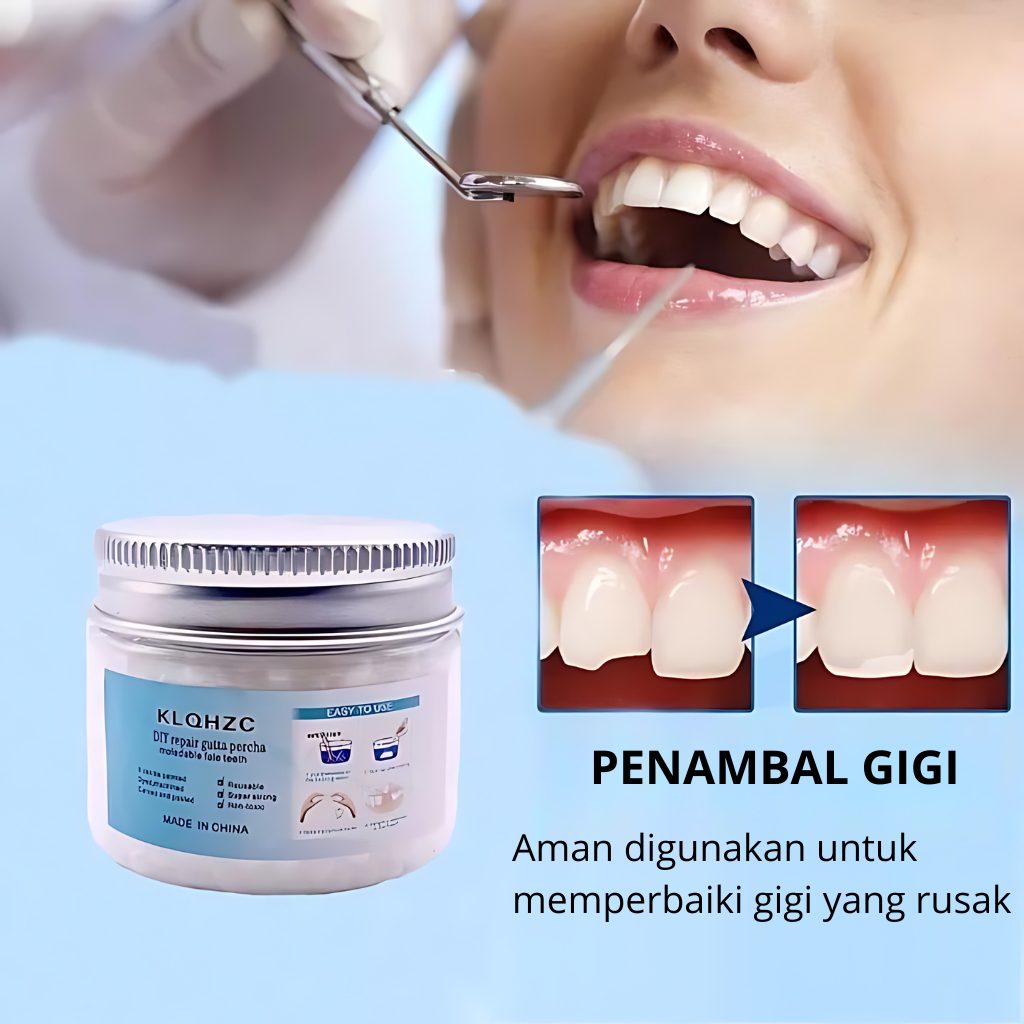 KLQHZC Temptooth Penambal Gigi Ompong Gigi Patah Renggang Pengganti Gigi Palsu_Butiran Penambal Gigi