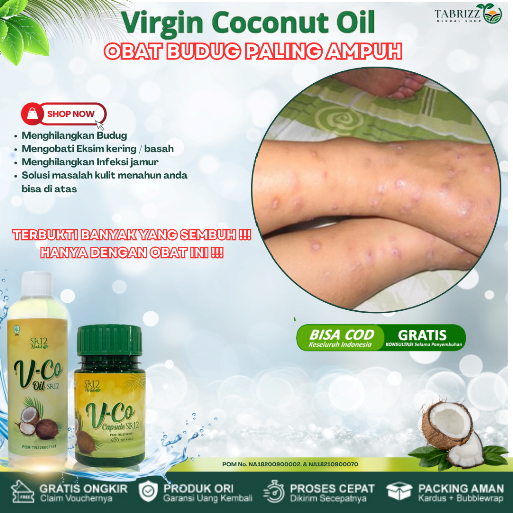 Obat Budug Paling Ampuh, Obat Budugan, Obat Budug Bernanah, Obat Scabies Manusia, Obat Borok, Obat P