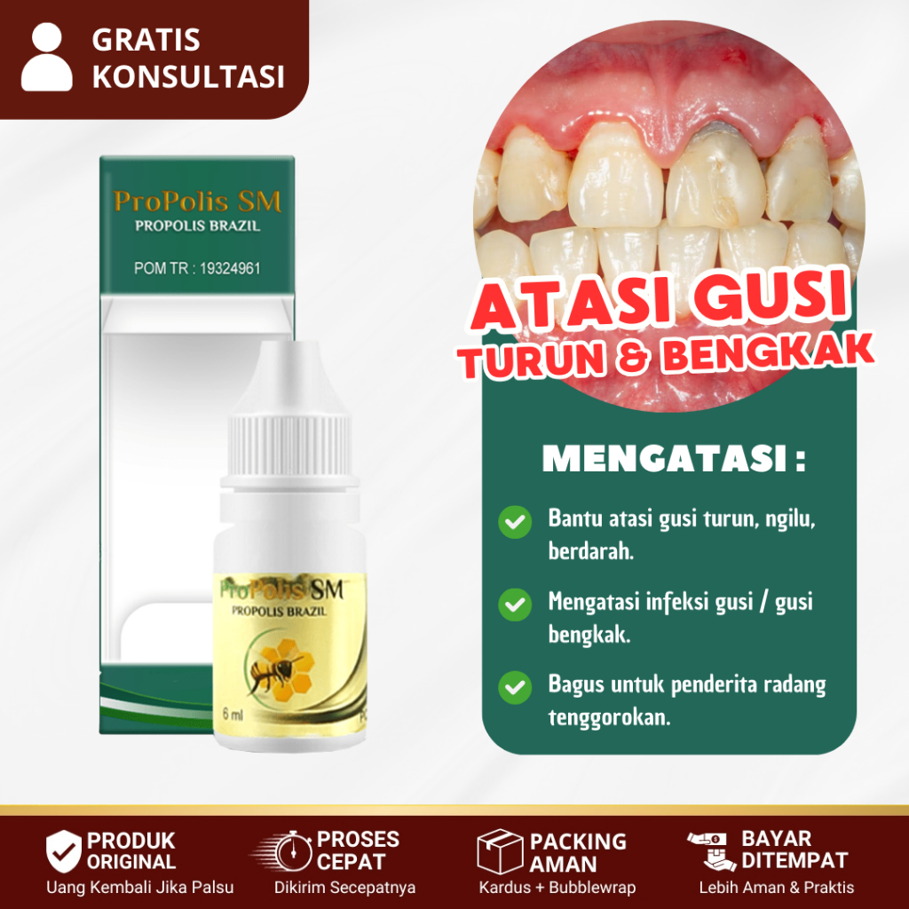 Obat Gusi Turun, Resesi Gusi, Gusi Ngilu, Berdarah, Bernanah, Bengkak, Infeksi - Propolis SM Brazil