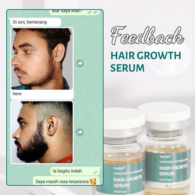 SERUM RAMBUT VERBLE- VERBLE SERUM PERTUMBUHAN RAMBUT / HAIR GROWTH SERUM