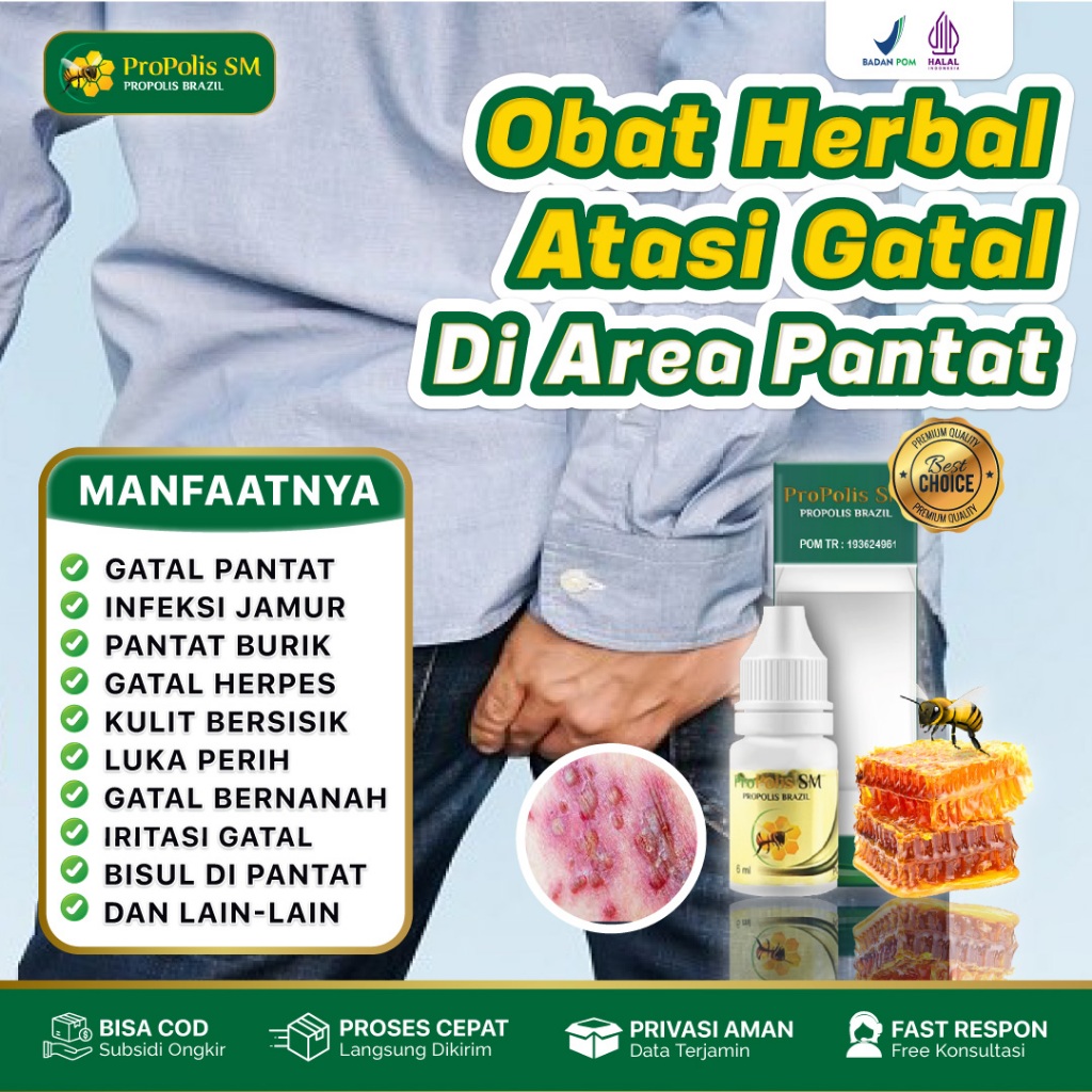 Obat Gatal Bokong Koreng Bruntusan Pantat Burik Propolis SM