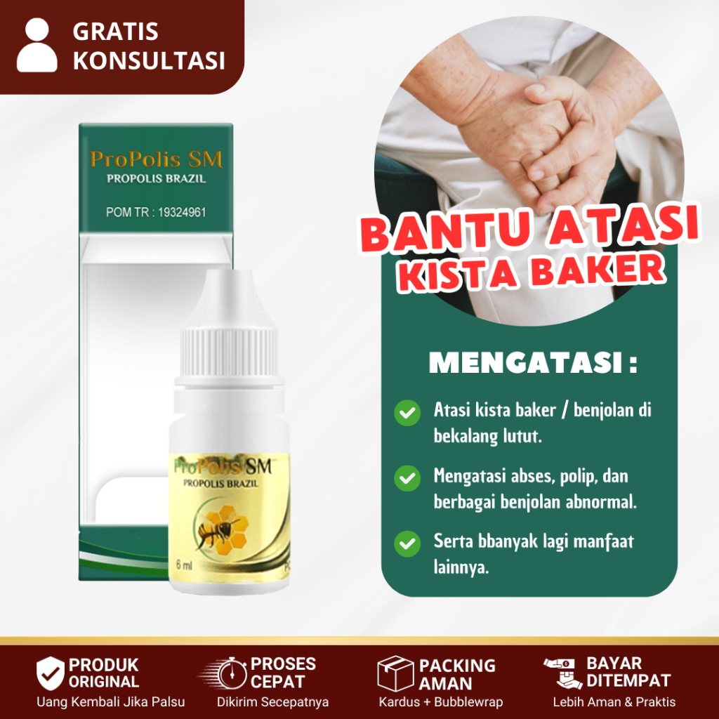 Obat Kista Baker / Kista Poplitea, Benjolan Di Belakang Lutut, Lutut Bengkak Dan Sakit - Propolis SM