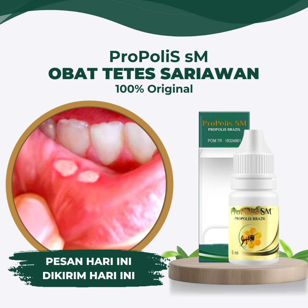 Obat Tetes Sariawan Di Bibir Sariawan Mulut Sariawan Anak Lidah Putih Berjamur Dan Bau Mulut - 6ml