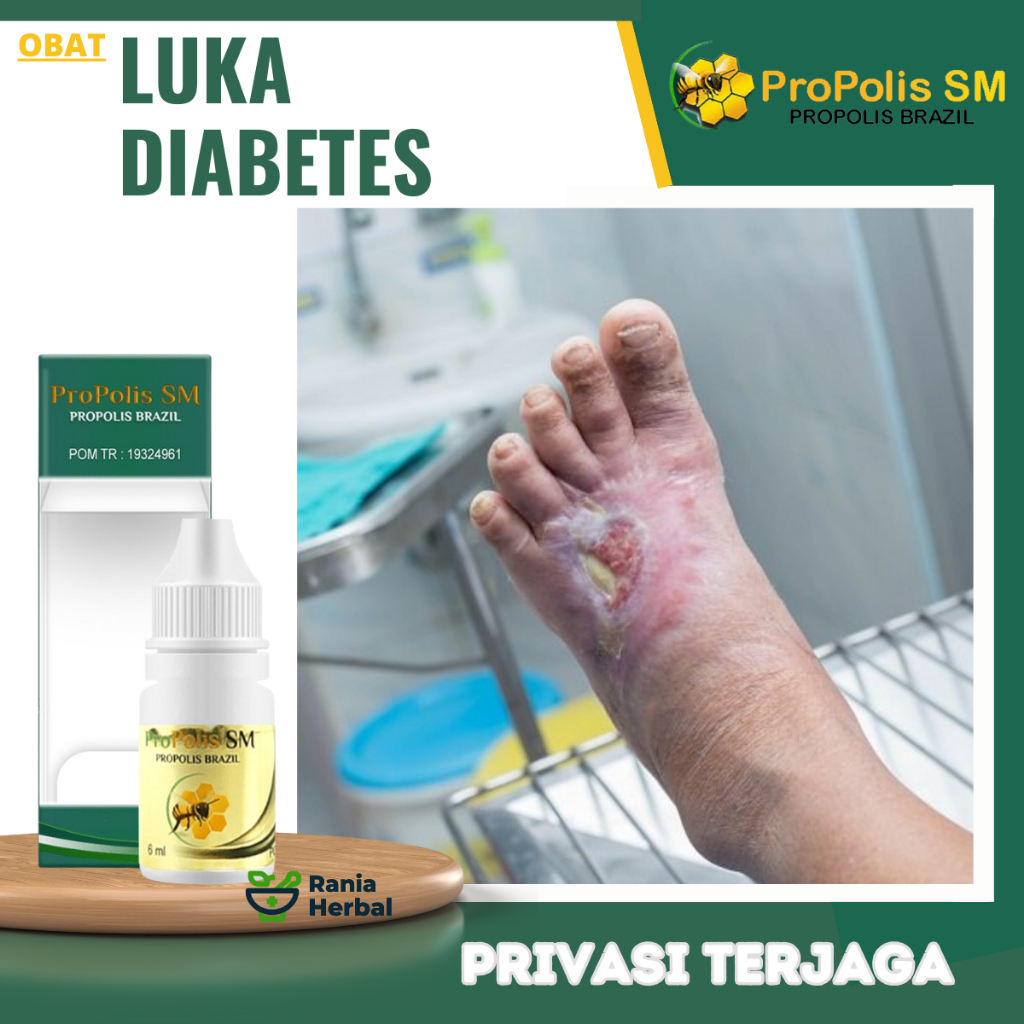 Obat Luka Diabetes, Obat Pengering Luka Diabetes, Obat Luka Diabetes Kering, Obat Luka Diabetes Basa