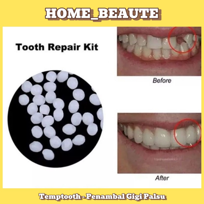 TEMPTOOTH Penambal Gigi untuk memperbaiki gigi ompong, gigi lubang, gigi gingsul, gigi patah dan mem