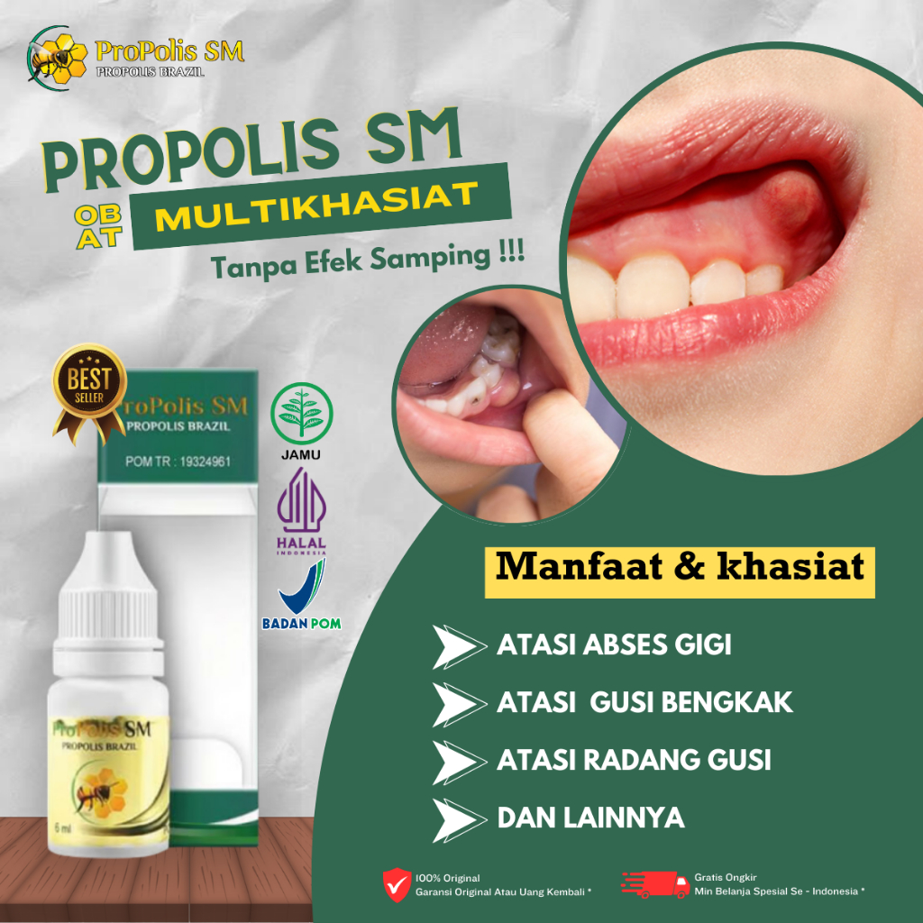 Obat Abses Gusi, Obat Gusi Bengkak, Obat Penghilang Nyeri Di Gusi, Obat gusi berdarah, Obat Radang G