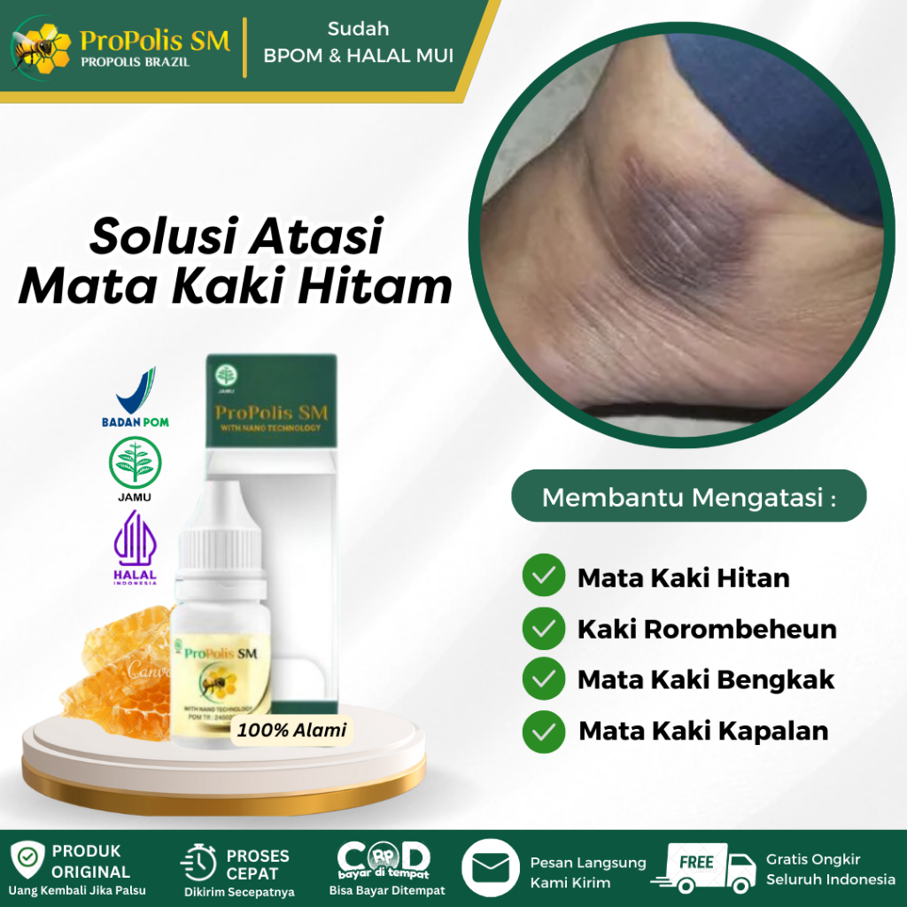 Salep Oles Untuk Mata Kaki Hitam, Mata Kaki Kapalan, Mata Kaki Bengkak, Mata Kaki Hitam dan Kasar, S