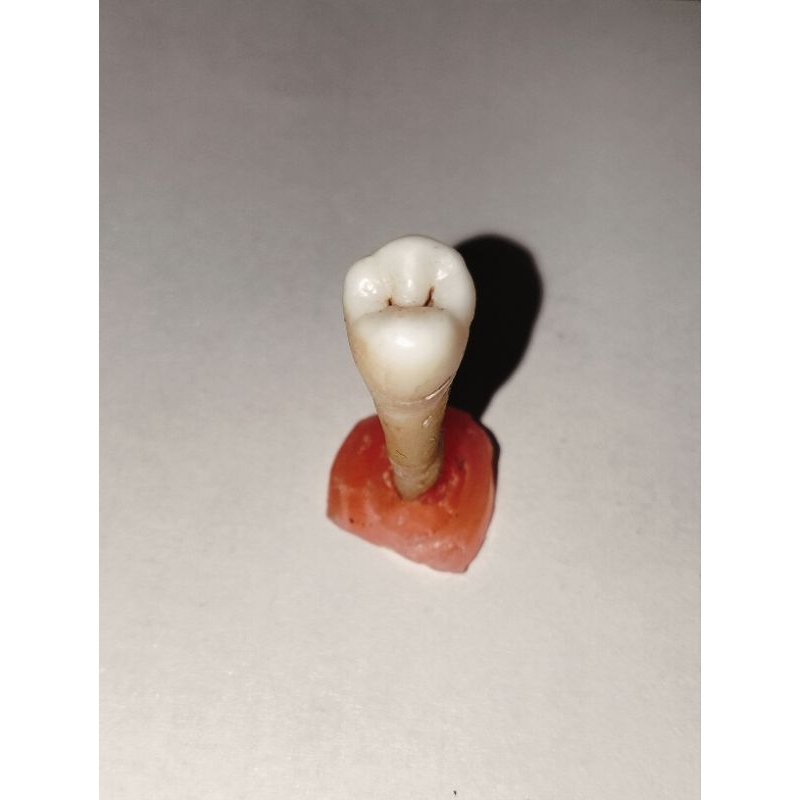 Gigi asli premolar 15