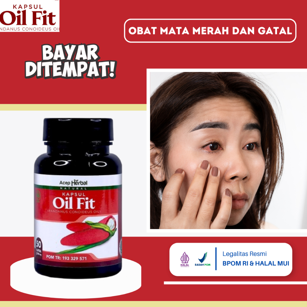 Obat Mata Merah Dan Gatal, Obat Mata Merah Parah, Obat Alergi Mata, Obat Penyakit Konjungtivitis, Ob