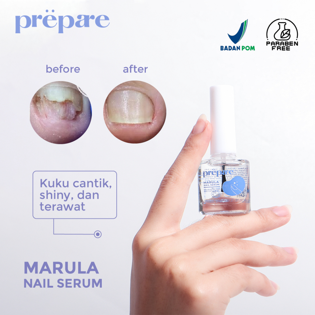 PREPARE - Serum Kuku Rusak Obat Cantengan Vitamin Kuku Obat Jamur Kuku Pedicure Menicure BPOM
