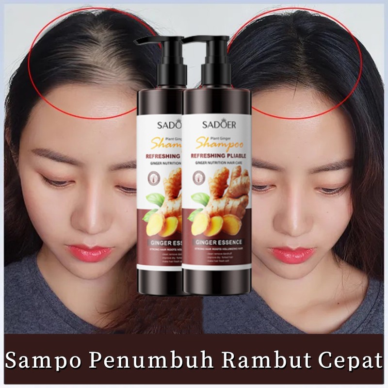 Sampo Penumbuh Rambut Cepat Bayi Sampo Jahe Rambut Perawatan Shampoo Penumbuh Rambut Botak Fast Grow
